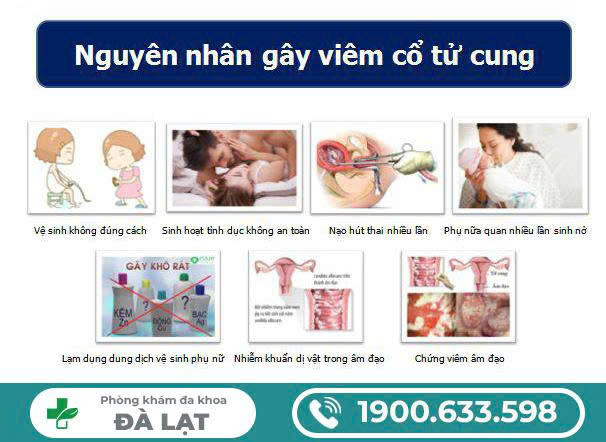 Hình ảnh minh họa